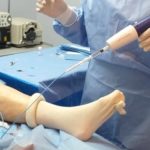 especialista en varices venaseal