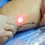 especialista en varices